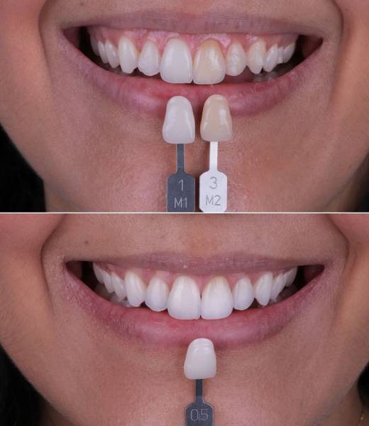 Carrusel casos MJ BELLO-5